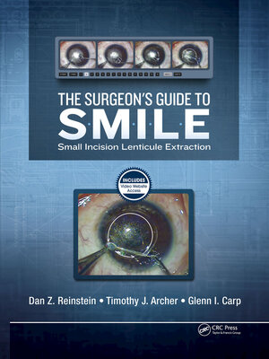 cover image of The Surgeon's Guide to SMILE